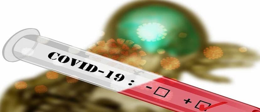 How Antibody Testing can Help us Fight Against Covid-19?