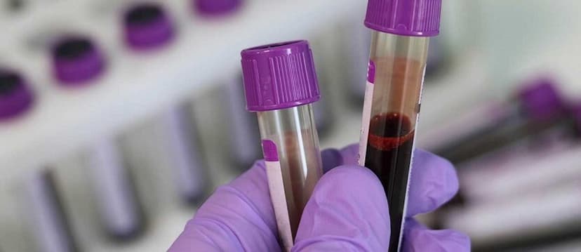 Vitamin B12 Level Test: Purpose, Procedure and Results