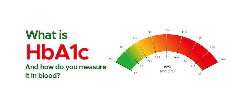 HbA1c Blood Test Report and Meaning: Glycated Hemoglobin Test