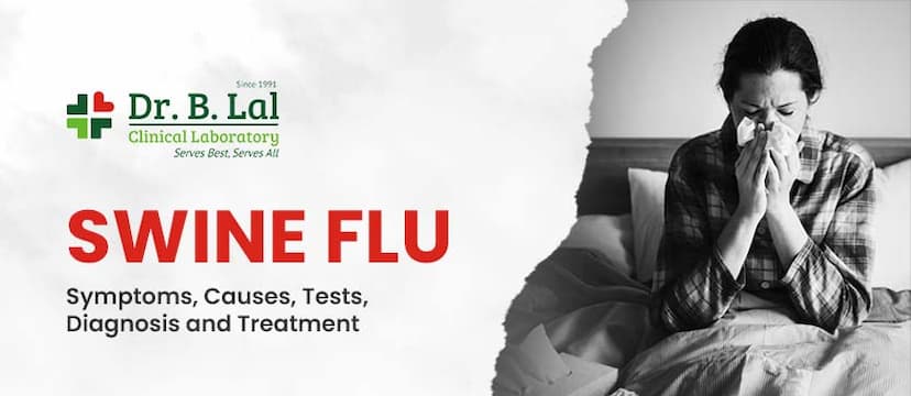 What is Swine Flu? Symptoms, Causes, Diagnosis and Treatment