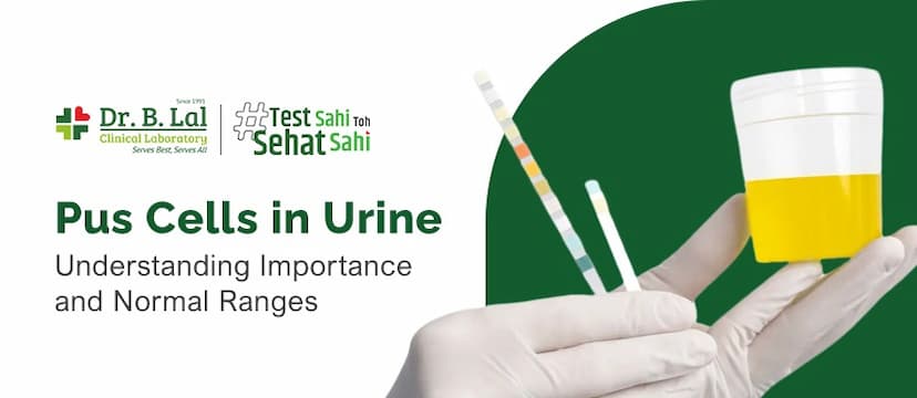 Pus Cells in Urine (1-2, 2-3, 4-6 hpf) Normal Range 