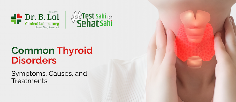 Common Thyroid Disorders: Symptoms, Causes, and Treatments