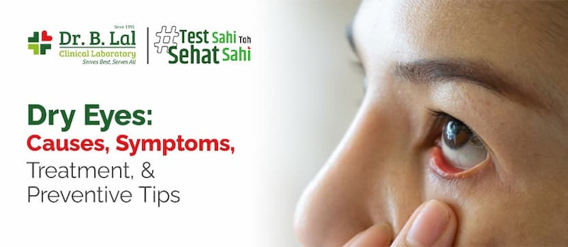 What is Dry Eye? Causes, Symptoms, Treatment, & Preventive Tips