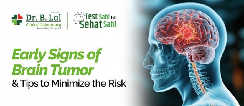 Early Signs of Brain Tumor & Tips to Minimize the Risk