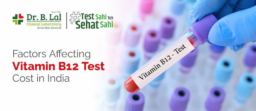 Vitamin Test Cost: Factors Affecting Vitamin B12 Test Cost in India