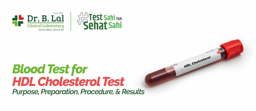 Blood Test for HDL Cholesterol: Purpose, Preparation, Procedure, & Results