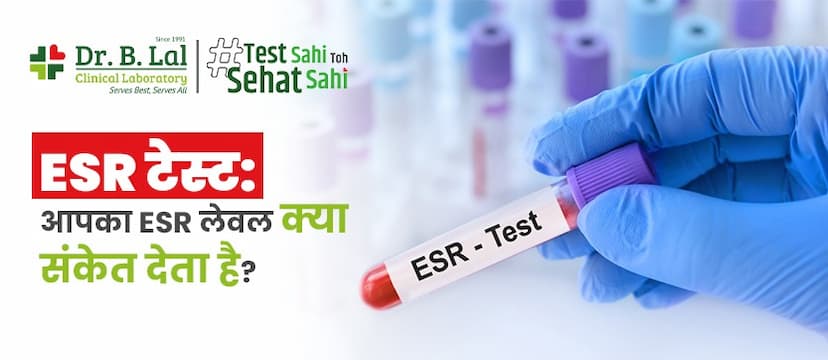 ESR टेस्ट: आपका ESR लेवल क्या संकेत देता है?