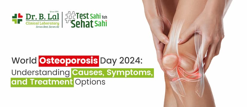 World Osteoporosis Day 2024: Understanding Causes, Symptoms, and Treatment Options