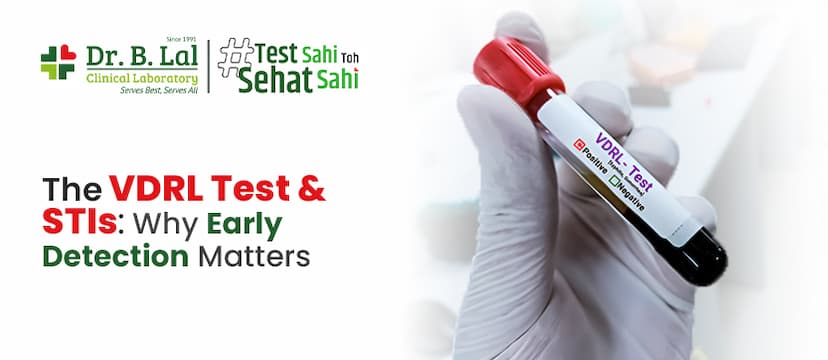   The Rapid Plasma Reagin (Modified VDRL Test & STIs: Why Early Detection Matters