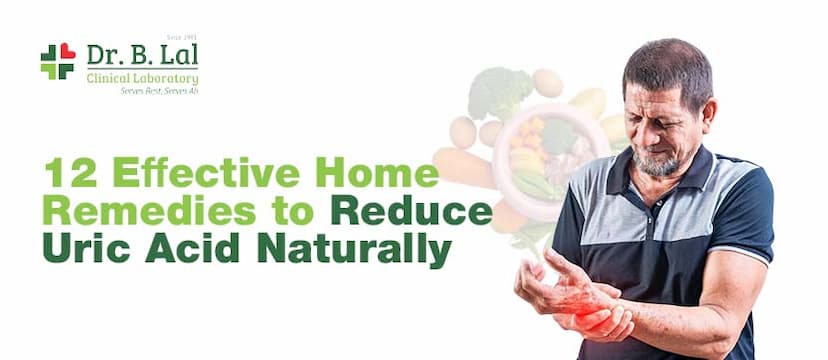 12 Effective Home Remedies to Reduce Uric Acid Naturally