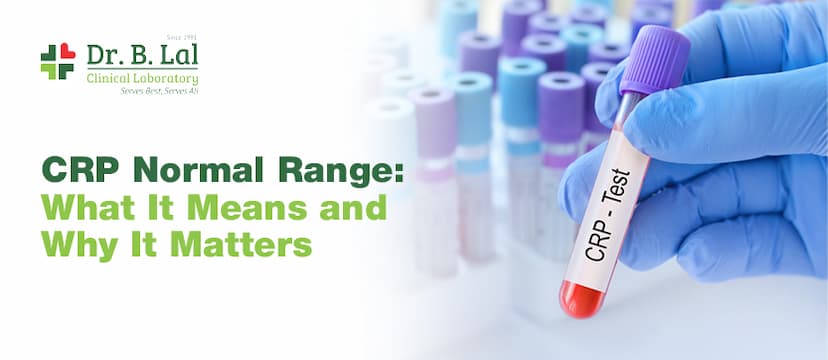 CRP Normal Range: What It Means And Why It Matters