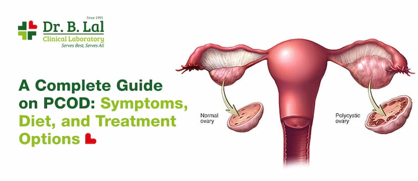 PCOD Complete Guide: Symptoms, Diet, and Treatment Options