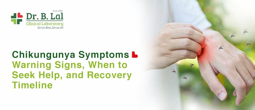 Chikungunya Symptoms: Warning Signs, When to Seek Help, and Recovery Timeline