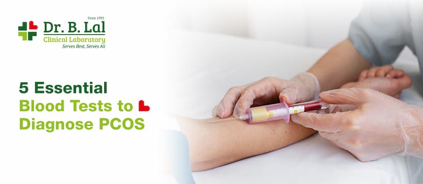 5 Blood Tests Every Woman Should Take for PCOS