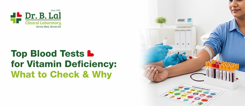 Essential Blood Tests for Vitamin Deficiency