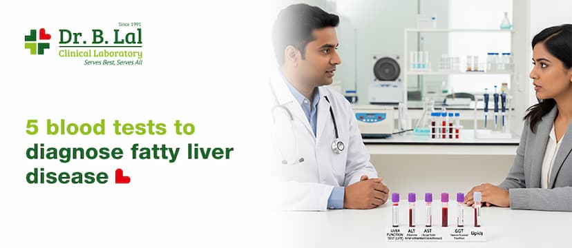 Fatty Liver Diagnosis: 5 Blood Tests You Should Know