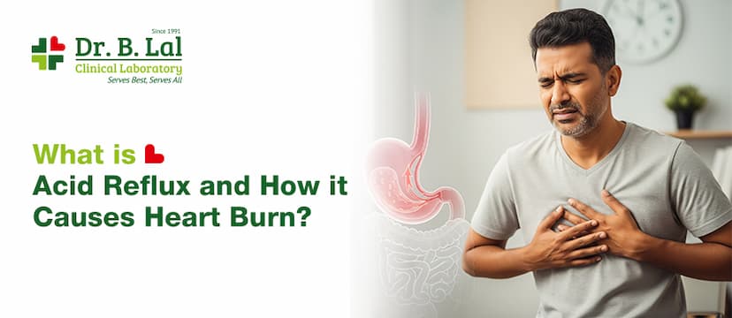 Acid Reflux Explained: Causes and Heartburn Link