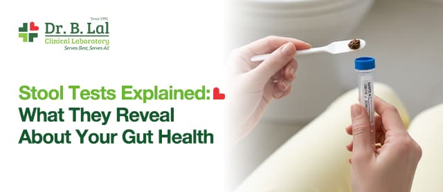 Stool Tests Explained: What They Reveal About Your Gut Health