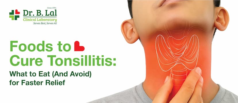 Foods to Cure Tonsillitis: What to Eat (And Avoid) for Faster Relief
