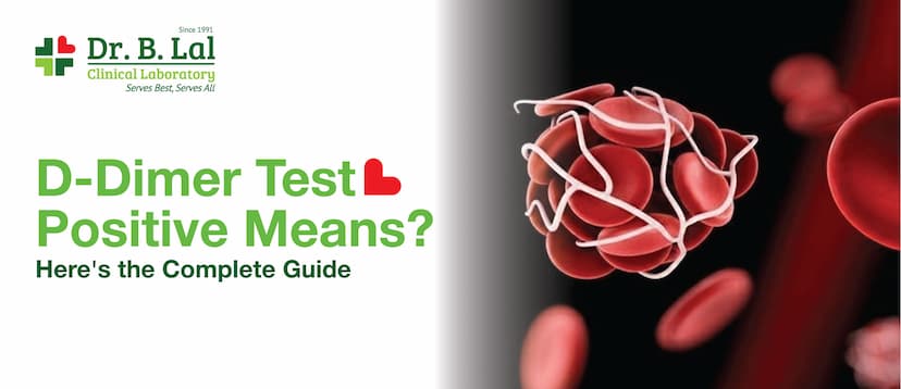 D-Dimer Test Positive Mean? Here’s the Complete Guide