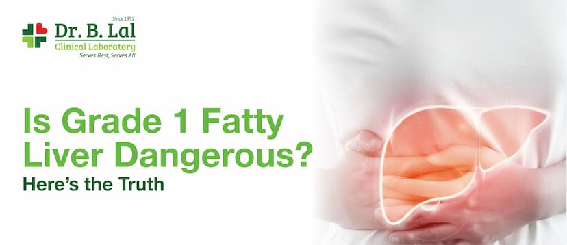 Is Grade 1 Fatty Liver Dangerous? Here’s the Truth