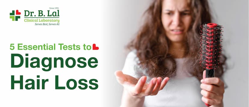 5 Essential Tests to Diagnose Hair Loss