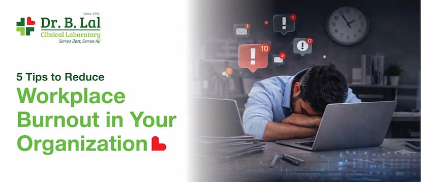 5 Tips to Reduce Workplace Burnout in Your Organization