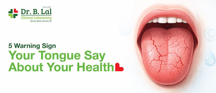 5 Warning Sign Your Tongue Say About Your Health