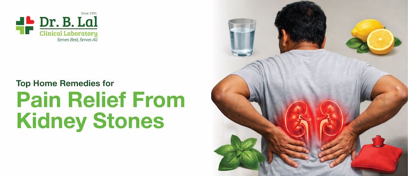 Top Home Remedies for Pain Relief From Kidney Stones