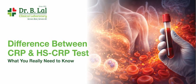 Difference Between CRP & HS-CRP Test: What You Really Need to Know