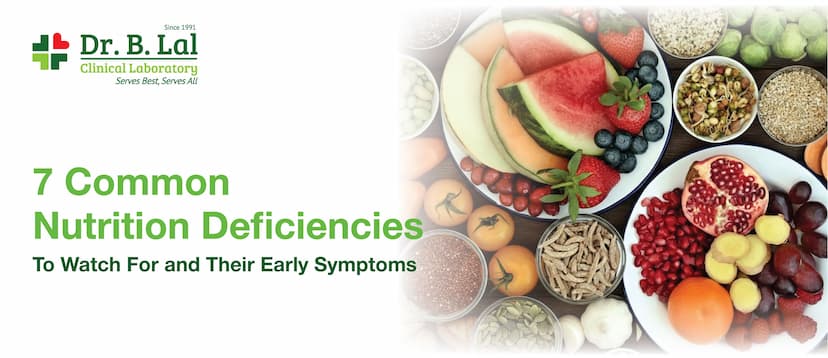 7 Common Nutrition Deficiencies To Watch For and Their Early Symptoms
