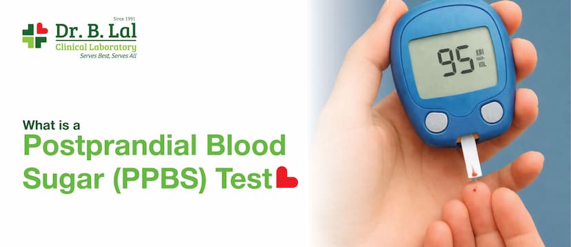 What is Postprandial Blood Sugar Test (PPBS Test)