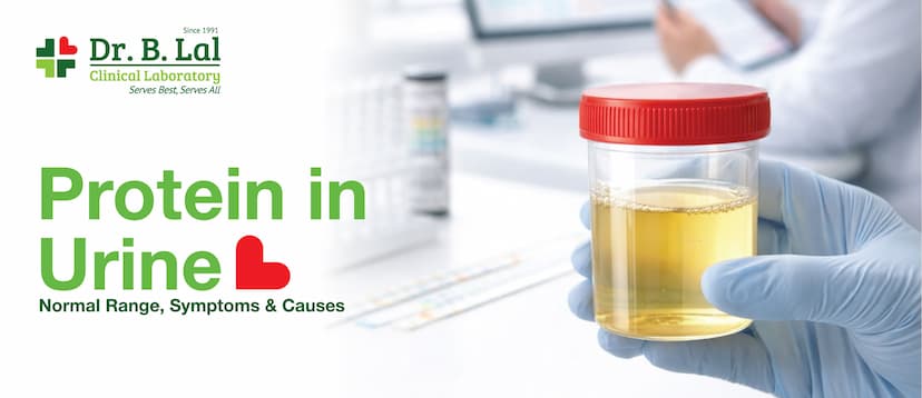 Protein in Urine: Normal Range, Symptoms & Causes