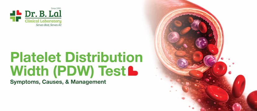 Platelet Distribution Width (PDW) Test: Symptoms, Causes & Management