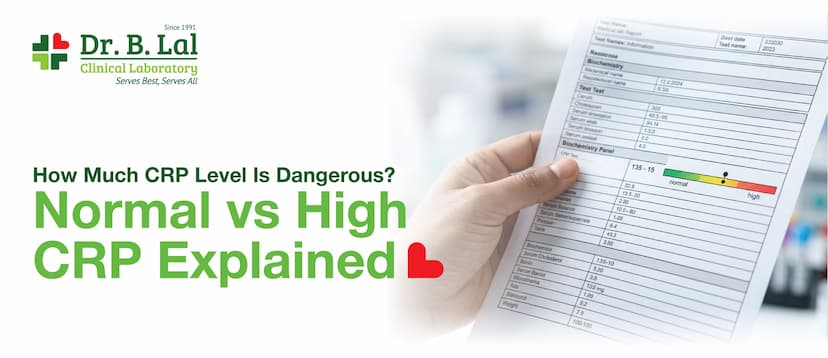 How Much CRP Level Is Dangerous? Normal vs High CRP Explained