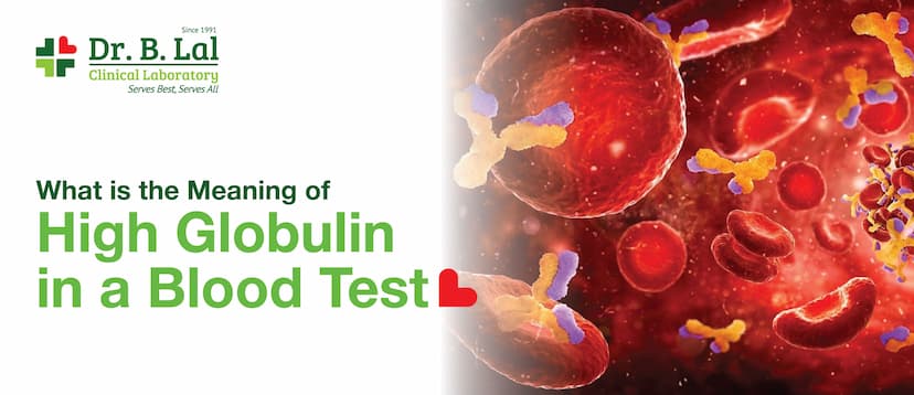 What Does High Globulin Mean in a Blood Test?