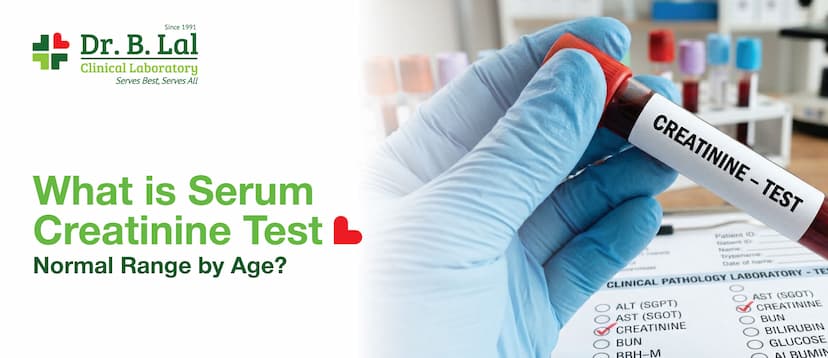 What is Serum Creatinine Test Normal Range by Age?